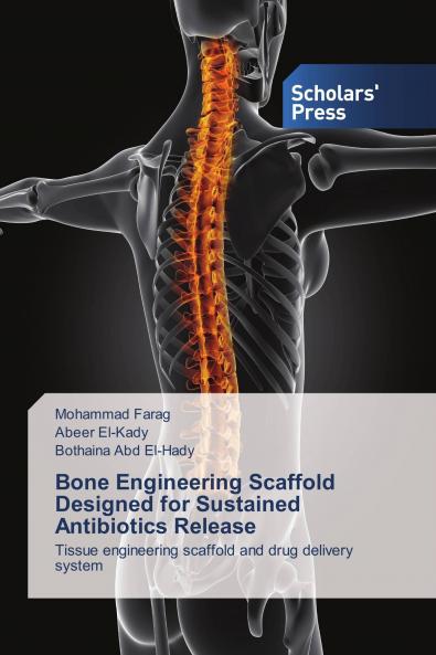 Bone Engineering Scaffold Designed for Sustained Antibiotics Release