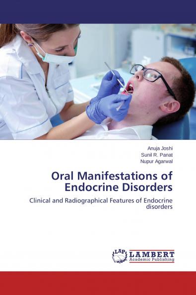 Oral Manifestations of Endocrine Disorders