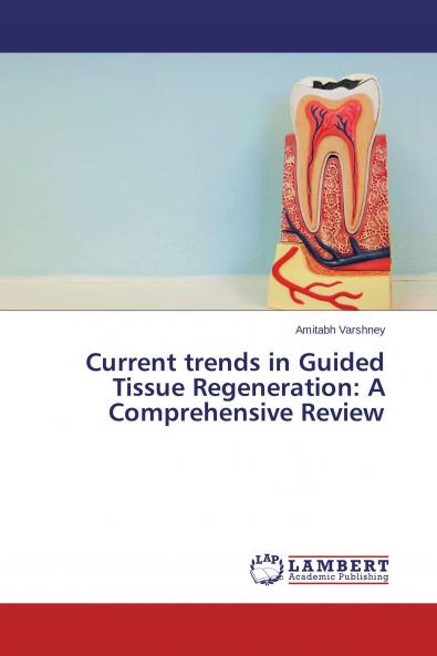 Current trends in Guided Tissue Regeneration