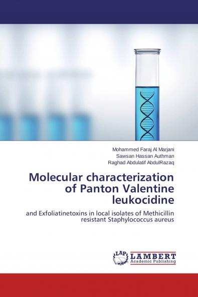 Molecular characterization of Panton Valentine leukocidine
