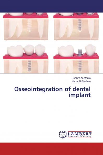 Osseointegration of dental implant