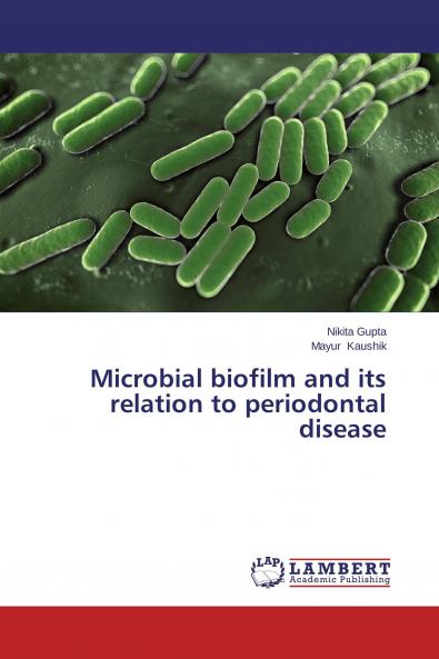 Microbial biofilm and its relation to periodontal disease