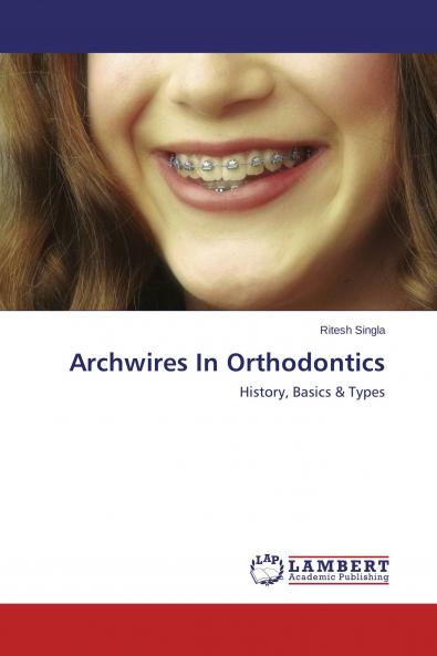Archwires In Orthodontics