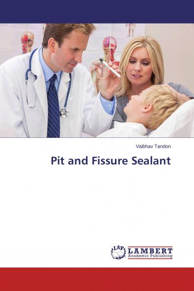 Pit and Fissure Sealant