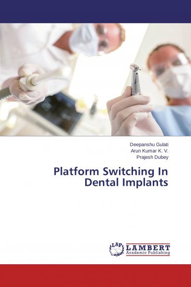 Platform Switching In Dental Implants