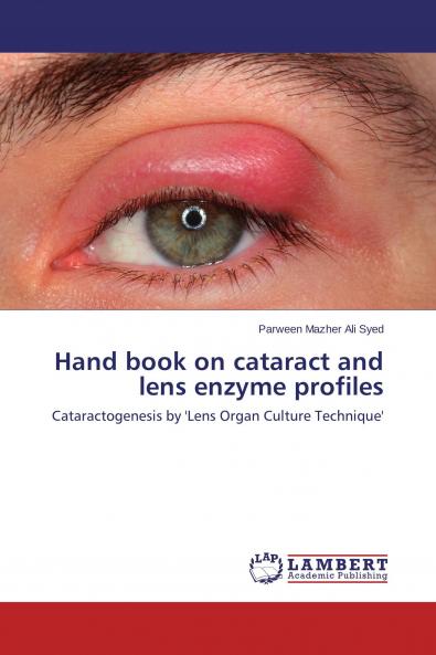Hand book on cataract and lens enzyme profiles