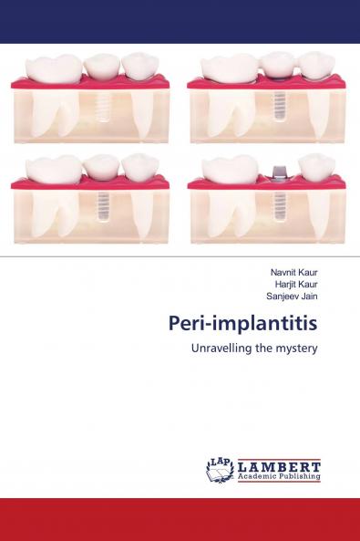 Peri-implantitis