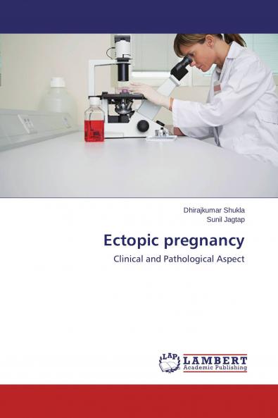 Ectopic pregnancy