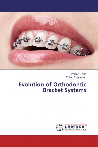 Evolution of Orthodontic Bracket Systems