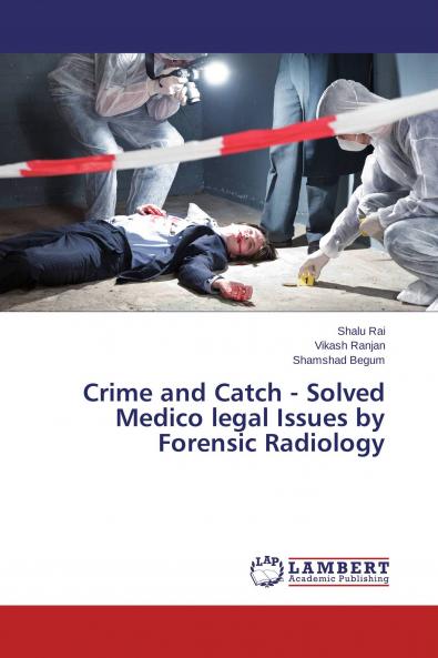 Crime and Catch - Solved Medico legal Issues by Forensic Radiology