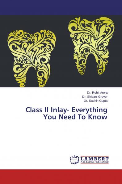 Class II Inlay- Everything You Need To Know