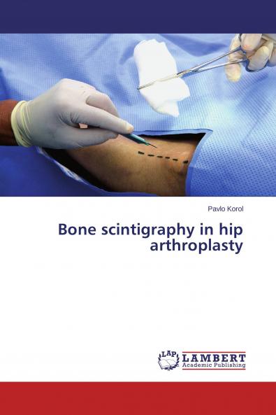 Bone scintigraphy in hip arthroplasty