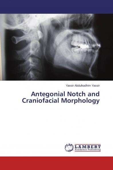Antegonial Notch and Craniofacial Morphology