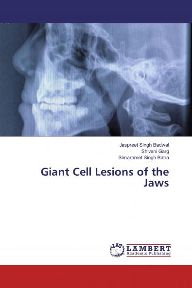 Giant Cell Lesions of the Jaws