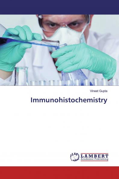 Immunohistochemistry