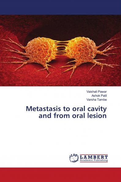 Metastasis to oral cavity and from oral lesion