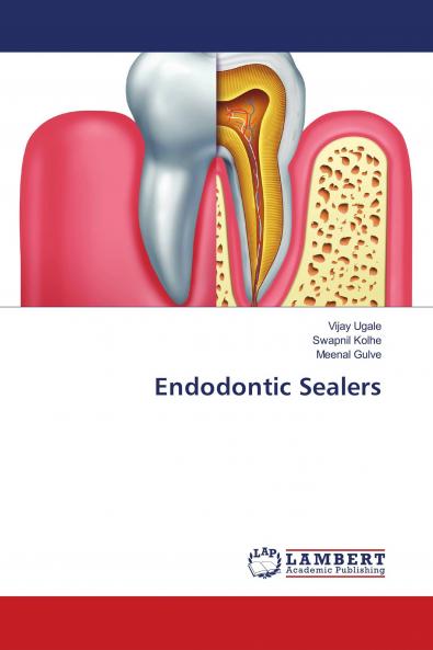 Endodontic Sealers
