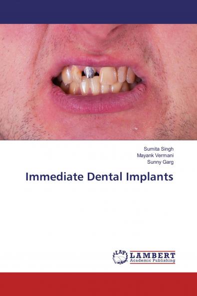 Immediate Dental Implants