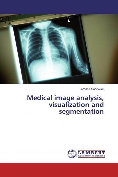 Medical image analysis visualization and segmentation