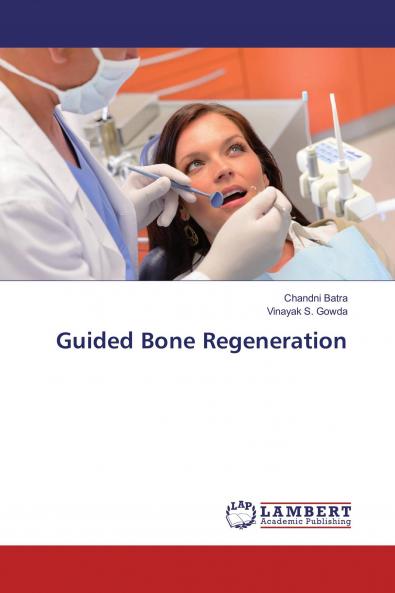 Guided Bone Regeneration