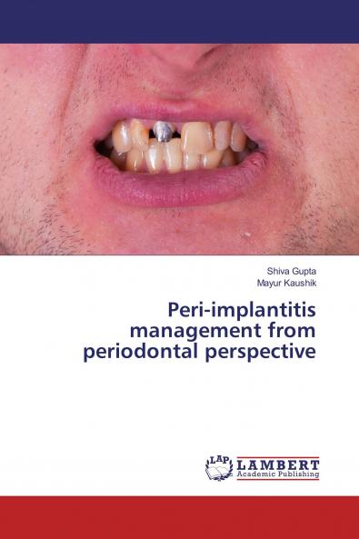 Peri-implantitis management from periodontal perspective