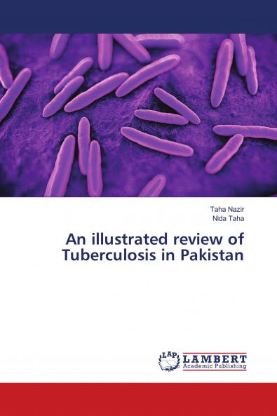 An illustrated review of Tuberculosis in Pakistan