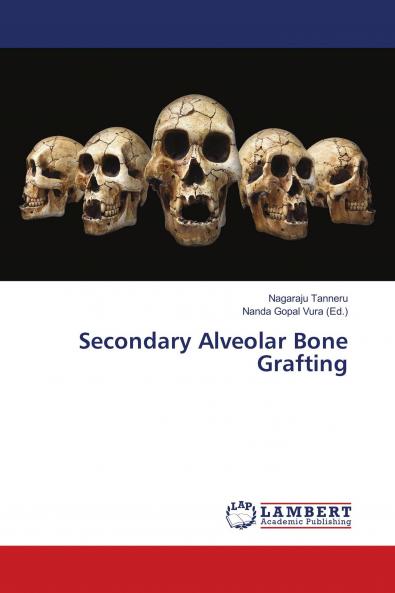 Secondary Alveolar Bone Grafting