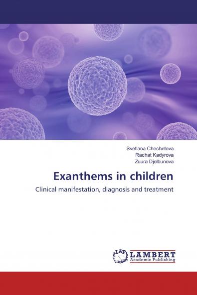 Exanthems in children