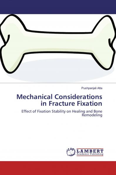 Mechanical Considerations in Fracture Fixation