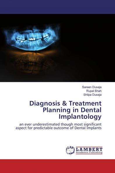 Diagnosis & Treatment Planning in Dental Implantology