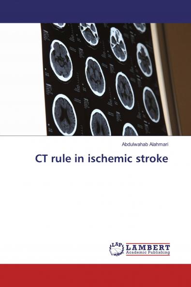 CT rule in ischemic stroke