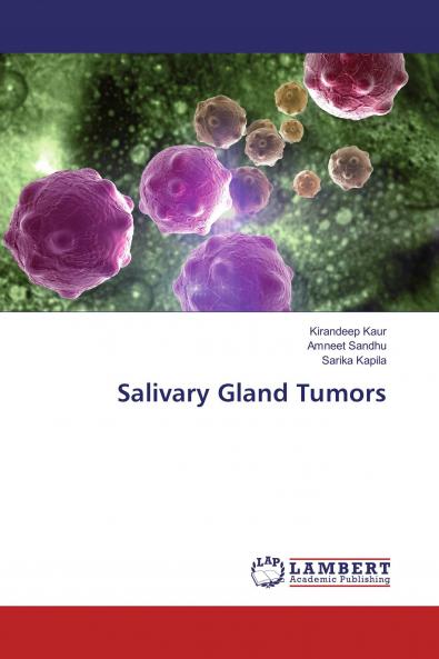 Salivary Gland Tumors