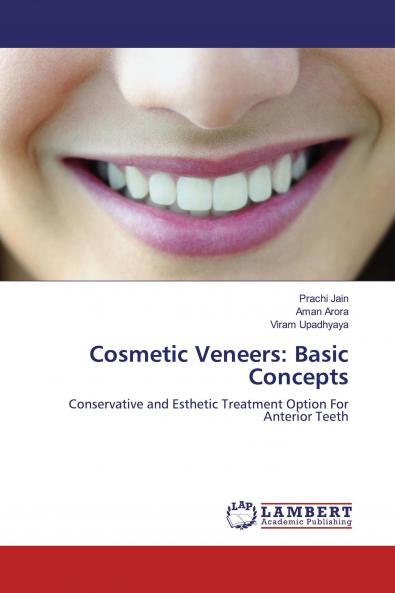 Cosmetic Veneers: Basic Concepts