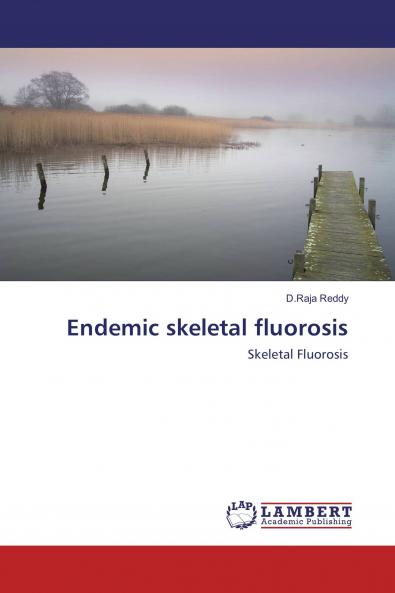 Endemic Skeletal Fluorosis