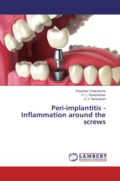 Peri-implantitis - Inflammation around the screws