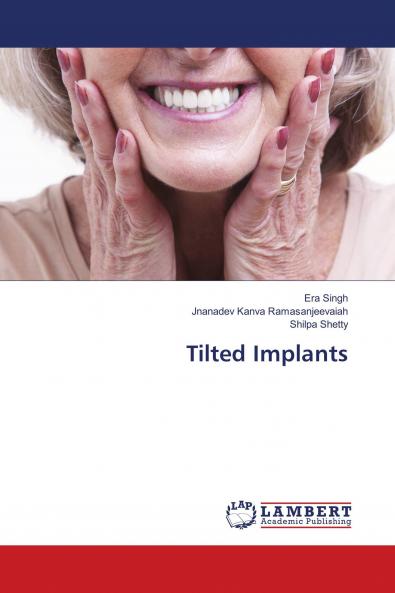 Tilted Implants