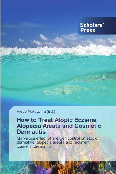 How to Treat Atopic Eczema, Alopecia Areata and Cosmetic Dermatitis