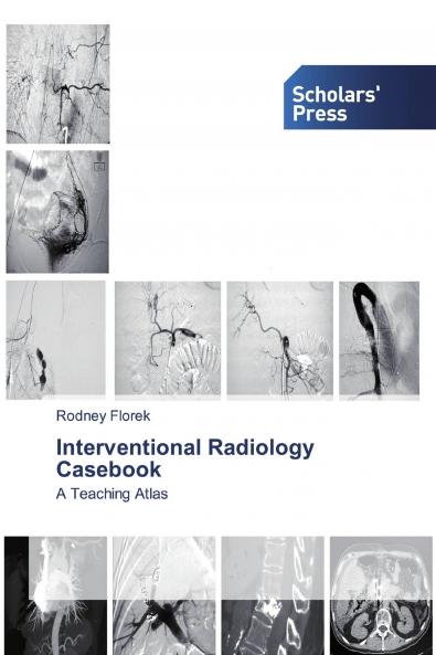 Interventional Radiology Casebook