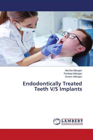 Endodontically Treated Teeth V/S Implants