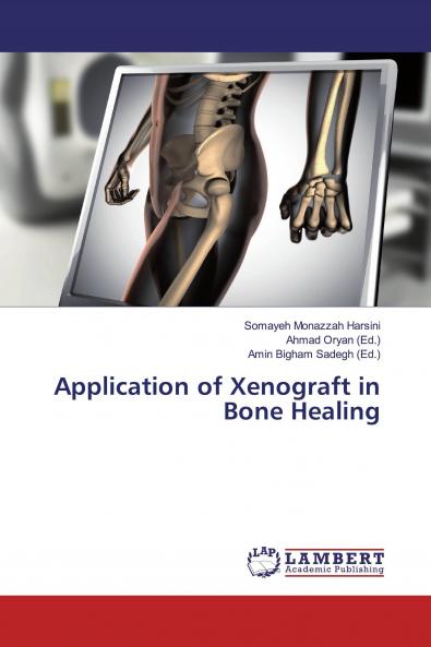 Application of Xenograft in Bone Healing