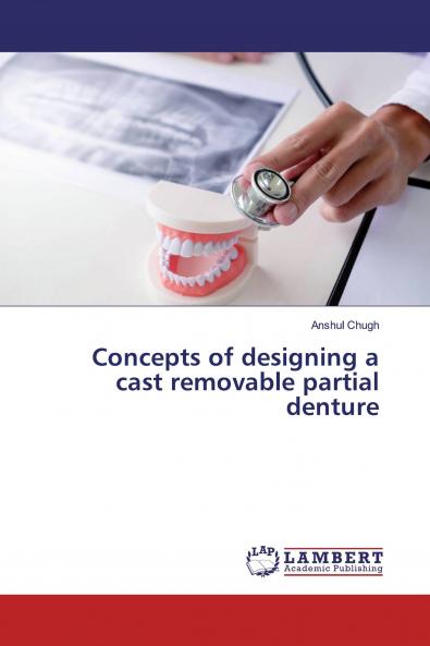 Concepts of designing a cast removable partial denture