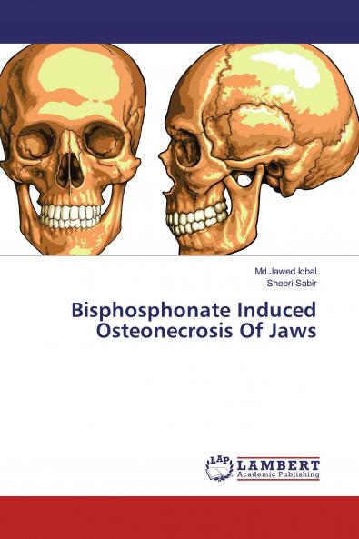 Bisphosphonate Induced Osteonecrosis Of Jaws