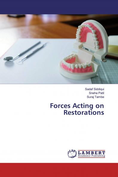 Forces Acting on Restorations