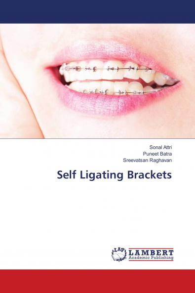 Self Ligating Brackets