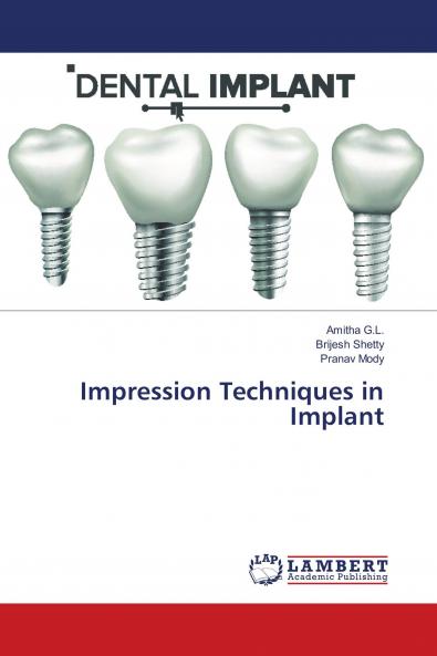 Impression Techniques in Implant