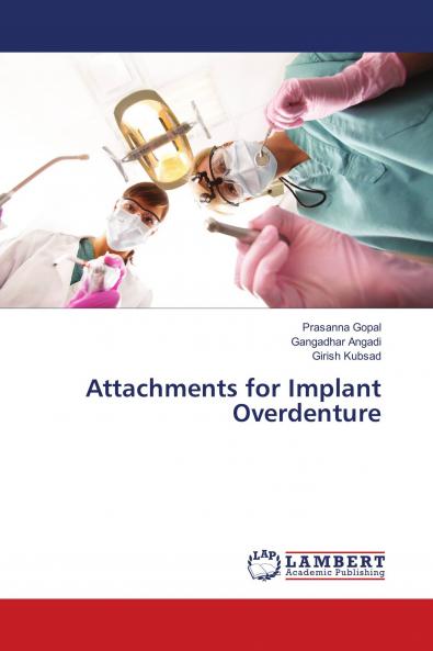 Attachments for Implant Overdenture