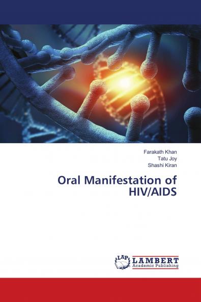 Oral Manifestation of HIV/AIDS