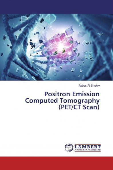 Positron Emission Computed Tomography (PET/CT Scan)