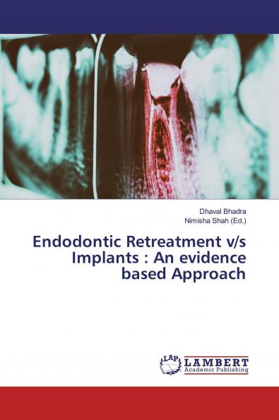 Endodontic Retreatment v/s Implants