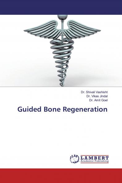 Guided Bone Regeneration